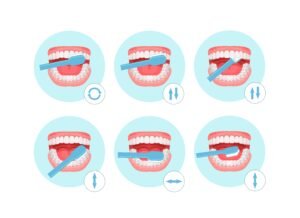 Tinkamos dantų valymo technikos: Patarimai, kaip pasiekti švaresnę ir sveikesnę šypseną